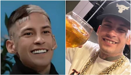 L-Gante reveló cuánto pagó su nueva dentadura y sorprendió a todos. Fotos: redes sociales.