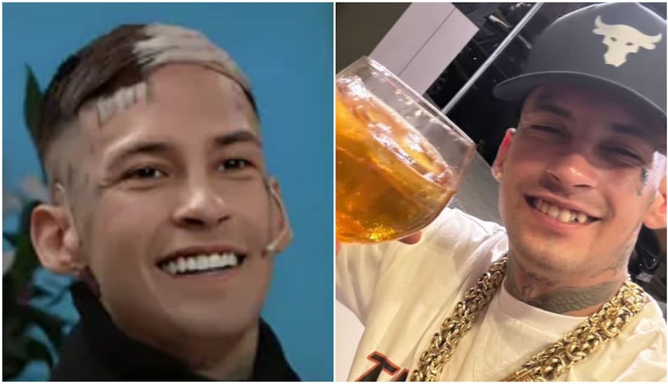 L-Gante reveló cuánto pagó su nueva dentadura y sorprendió a todos. Fotos: redes sociales.