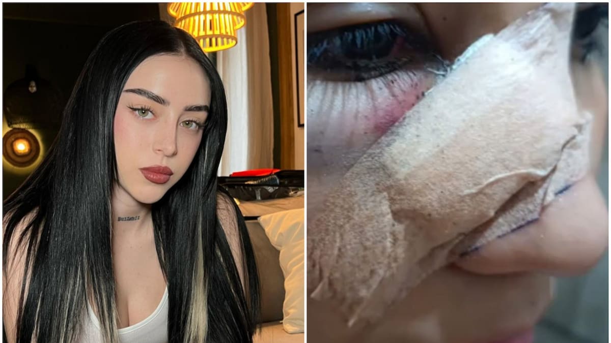 Fan de Nicki Nicole terminó herida por un botellazo. Fotos: Instagram - captura video.