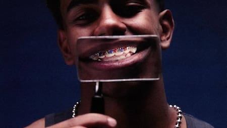 Lamine Yamal con sus brackets de color azulgrana.