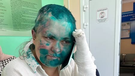 Elena Milashina, desde el hospital en Moscú. Foto: AP.