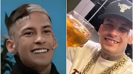 L-Gante reveló cuánto pagó su nueva dentadura y sorprendió a todos. Fotos: redes sociales.