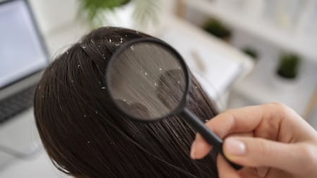 Como cuidar el cabello. Fuente: Freepik