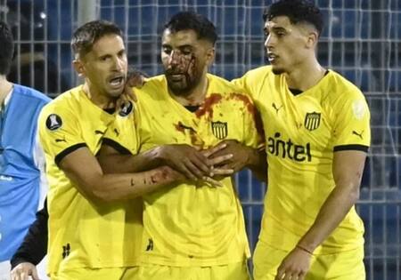 Un jugador de Peñarol fue agredido tras el partido ante Rosario Central. Foto: NA.