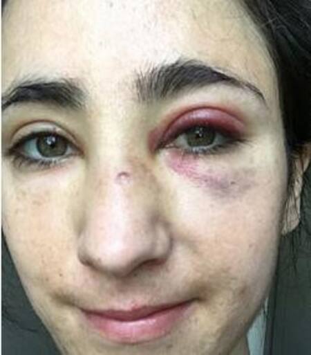 Azafata uruguay y novia agredidas en Londres