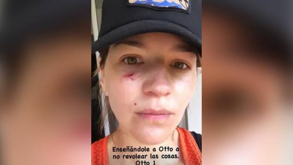 Marcela Kloosterboer sufrió heridas en su rostro