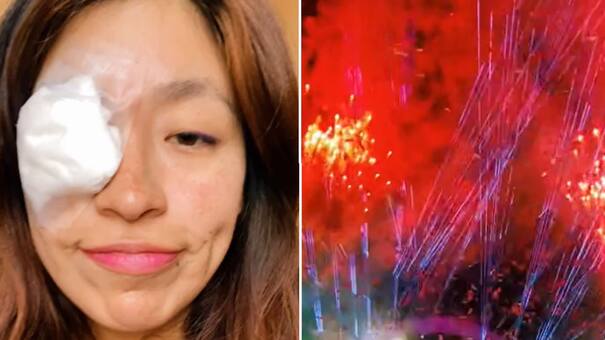 La odisea de una fanática en el recital de Karol G en Perú: sufrió un accidente en su ojo debido a los fuegos artificiales