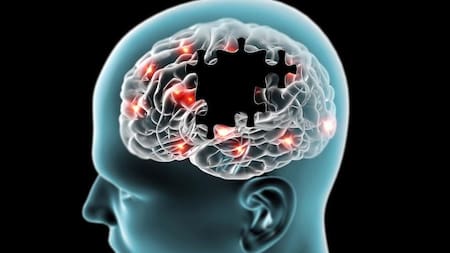 La desorientación puede ser el primer signo de Alzhéimer