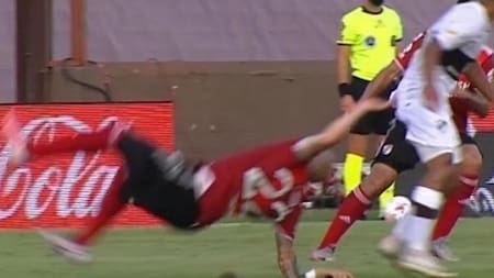 Platense vs. River, fútbol argentino, fractura de Pinola, foto ESPN