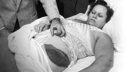 Ann Hodges, la mujer que sobrevivió tras ser golpeada por un meteorito