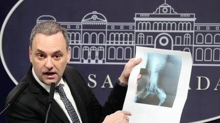 Manuel Adorni muestra la radiografía de un perro. Foto: Prensa Presidencia
