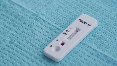 Test COVID-19 Islandia