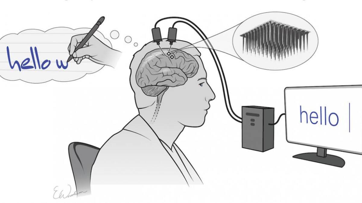 Implante cerebral