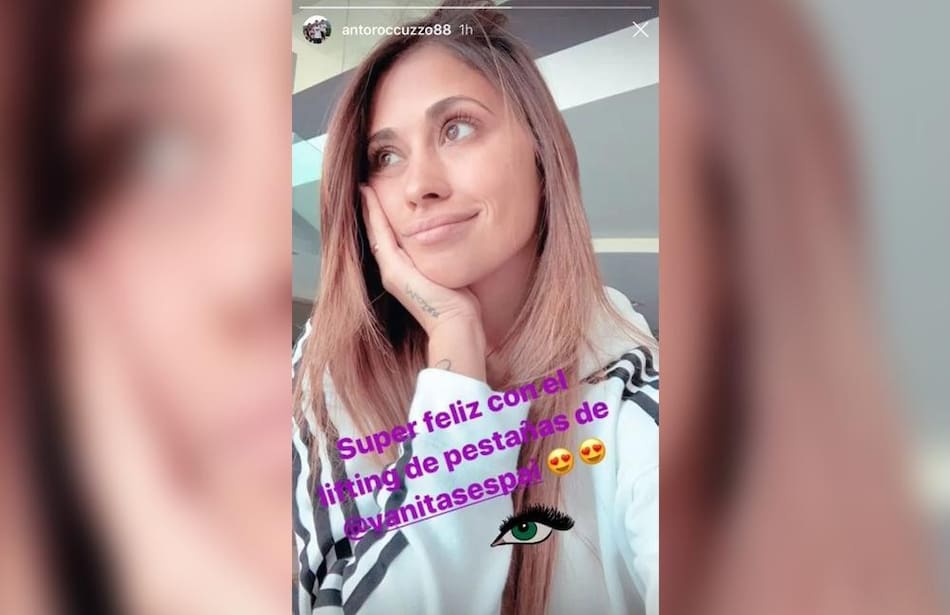 Así quedó Antonela Roccuzzo tras su retoque estético