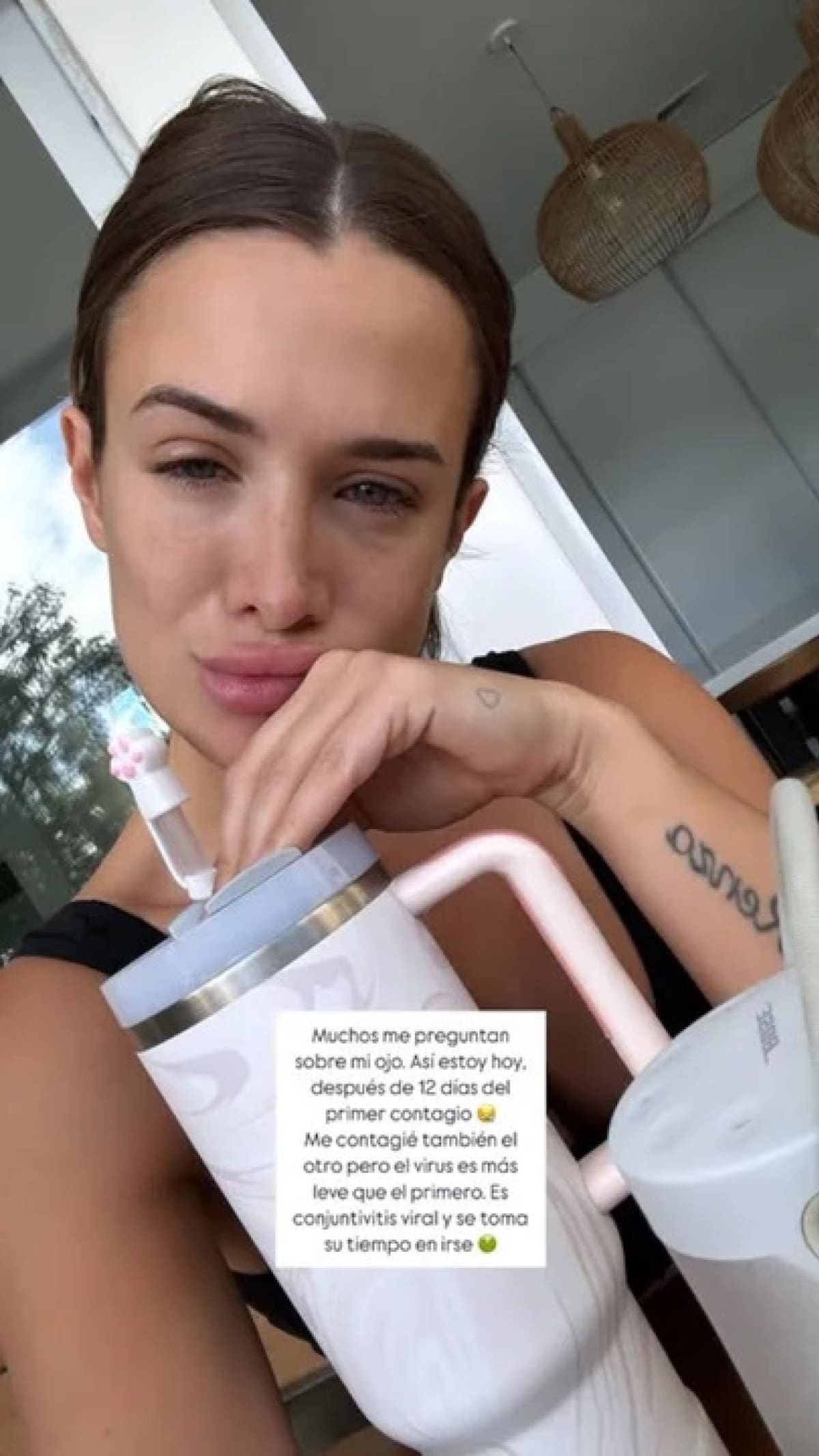 Camila Homs reveló la situación de salud que atraviesa. Foto: NA.