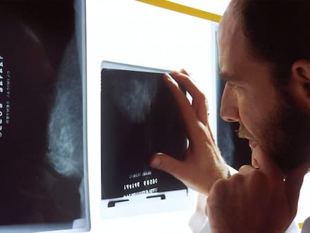 Cáncer colorrectal, salud, Reuters