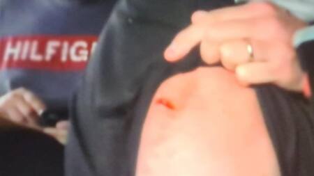 Inseguridad, robo, herido, motochorros, NA