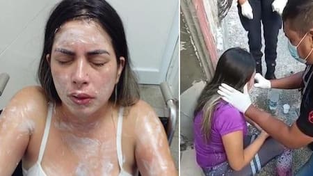 Ataque a joven en Tucumán