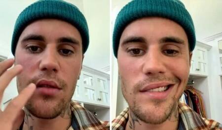 La parálisis que sufrió Justin Bieber. Foto NA.