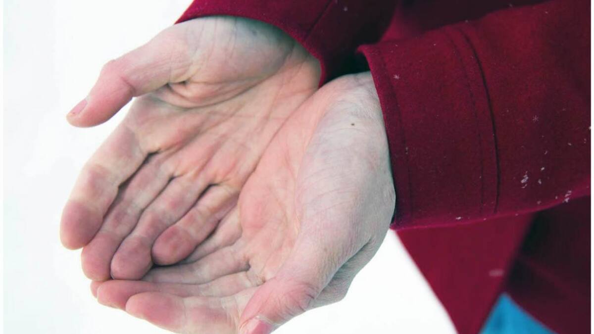 Esclerodermia