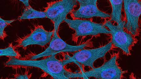 Cáncer pélvico. . Foto: Unsplash