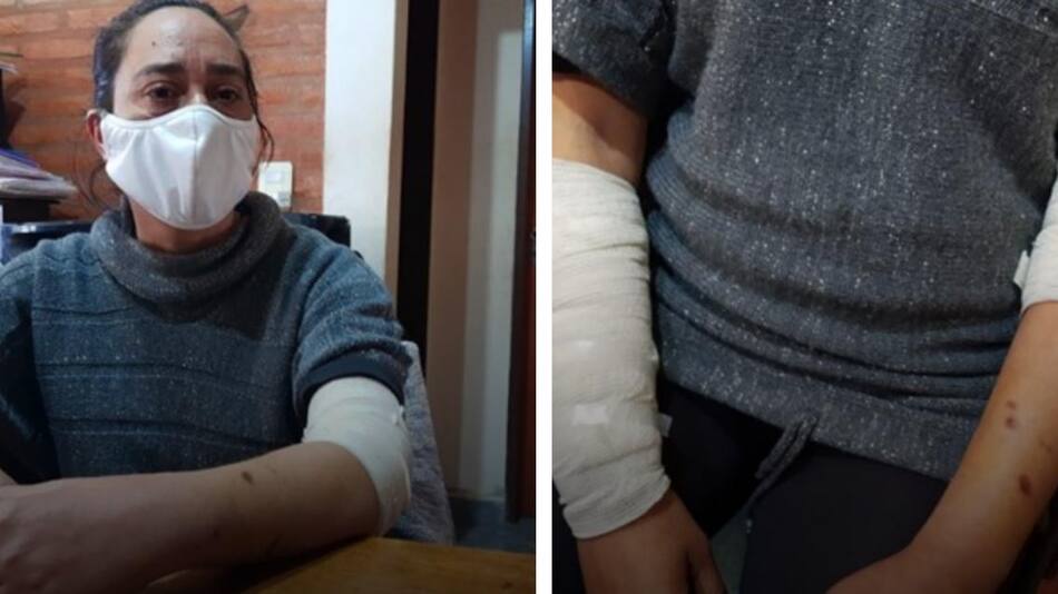 Ataque de perros a mujer en Córdoba