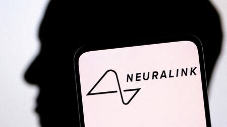 La empresa de neurotecnología, Neuralink. Foto: Reuters