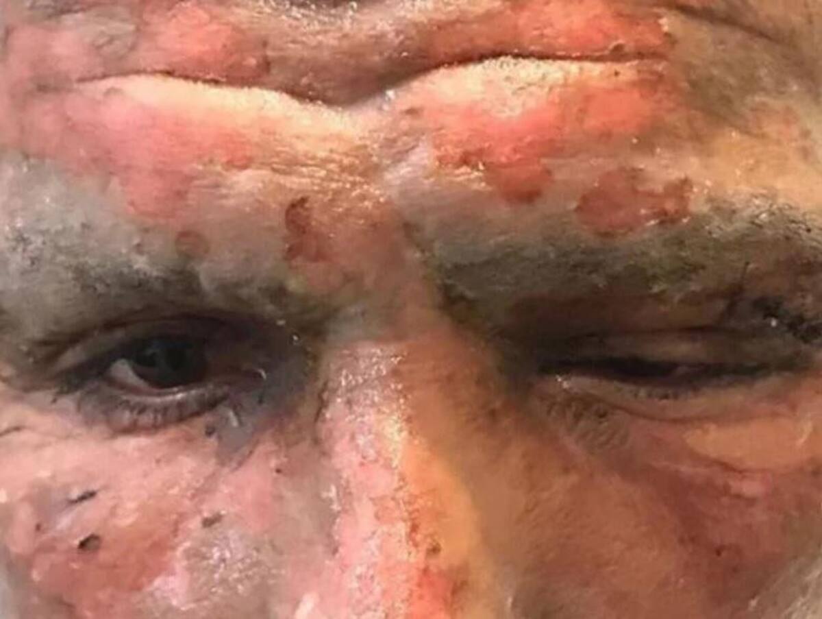 Accidente de Lucas Viatri con pirotecnia