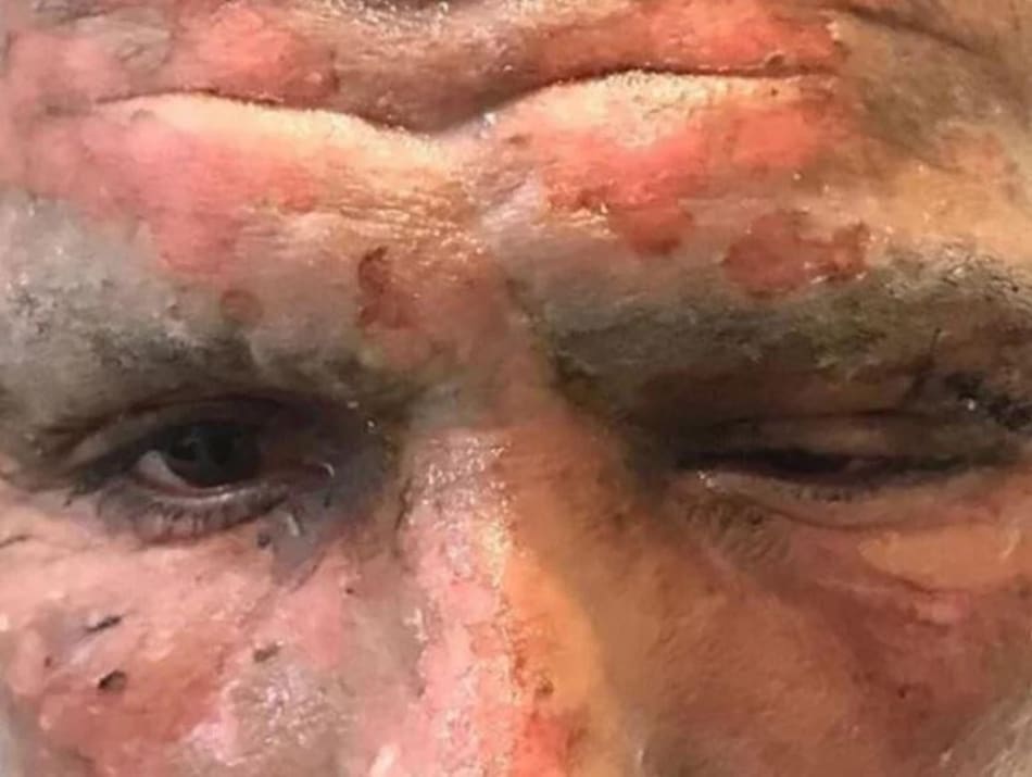 Accidente de Lucas Viatri con pirotecnia
