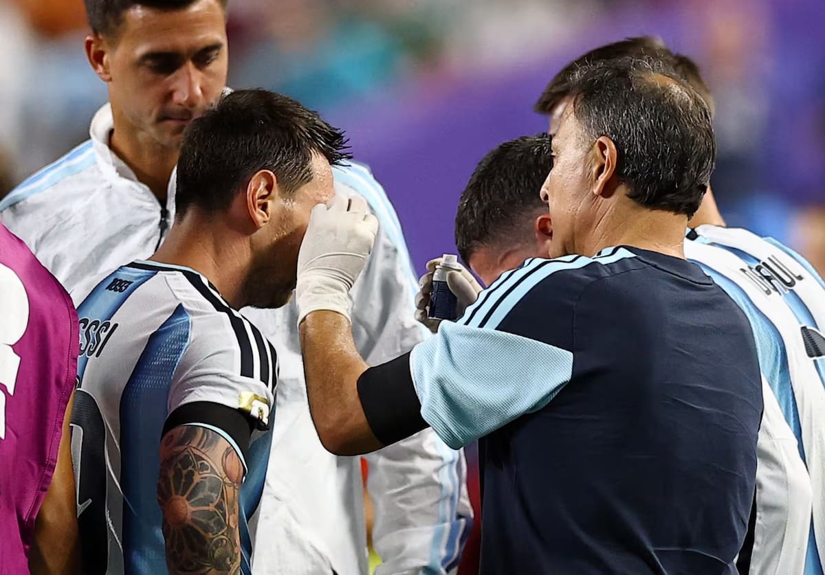 ¿Qué le pasó a Messi en el ojo?