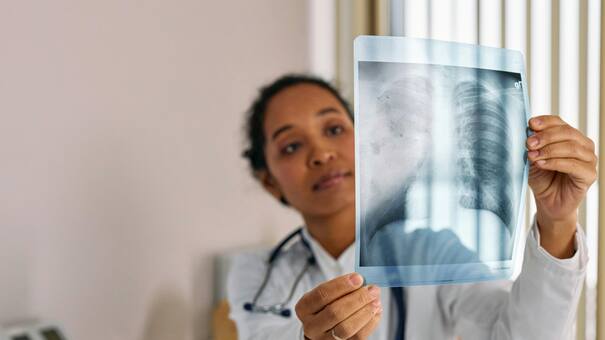 Neumonía: un problema de salud que impacta a niños y adultos  mayores en todo el mundo