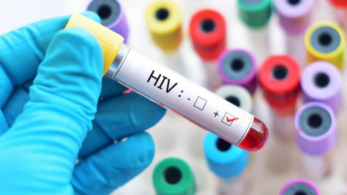 HIV