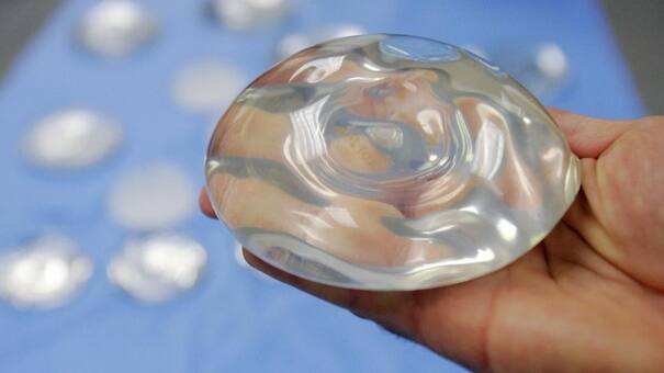 Los implantes mamarios podrían estar relacionados con otros tipos de cáncer