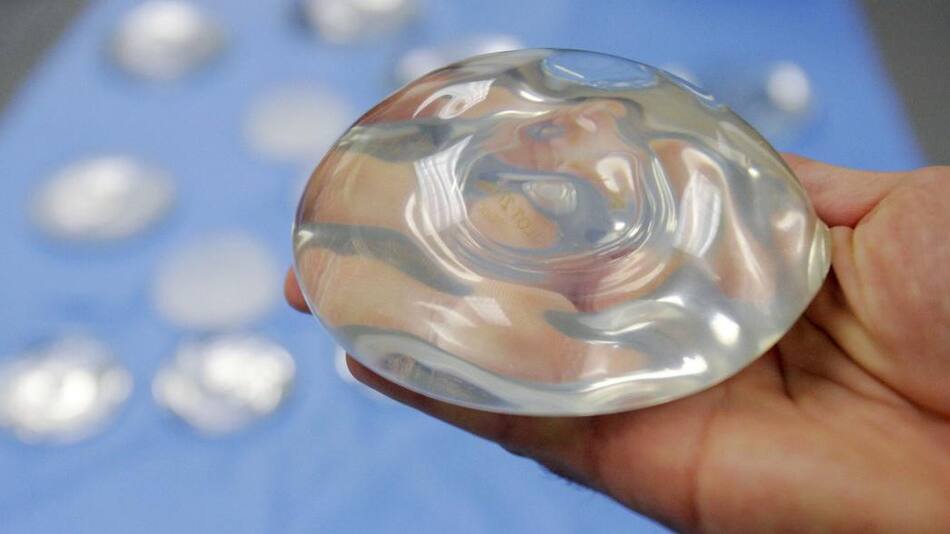 Implantes mamarios