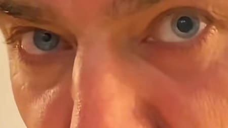 La clara diferencia entre los dos ojos. Foto: TikTok @angi_gullaci