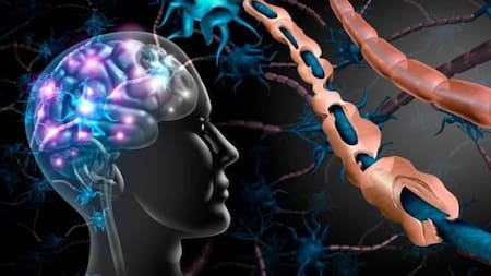 Esclerosis múltiple, salud, medicina