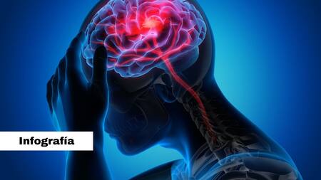 Infografía migrañas. Foto: Pixabay