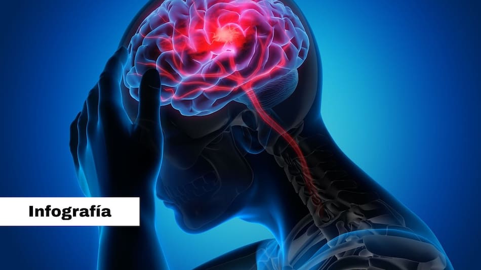 Infografía migrañas. Foto: Pixabay