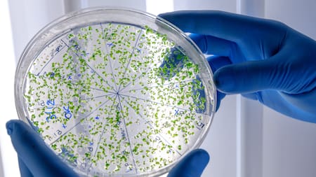 Alerta sanitaria por cianobacterias: en qué zona de Buenos Aires aparecieron y qué riesgos representan para la salud