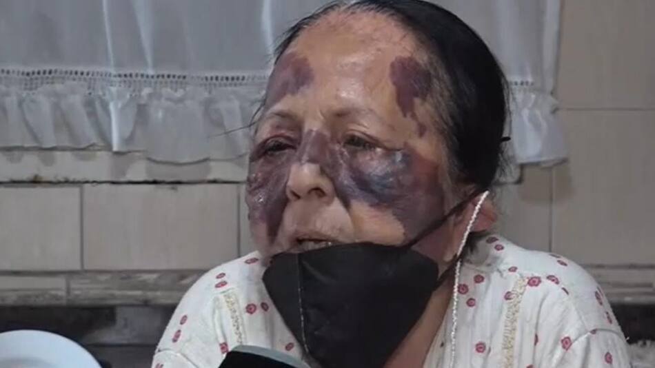 Mujer anciana golpeada en robo