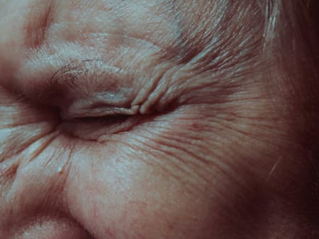 Arrugas. Foto: Unsplash