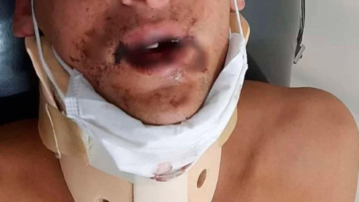 Brutal pelea de rugbiers en Mar del Plata, joven agredido.