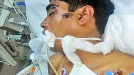 Hombre golpeado e internado