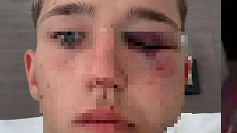 Golpiza a un adolescente de 17 años en una fiesta, NA