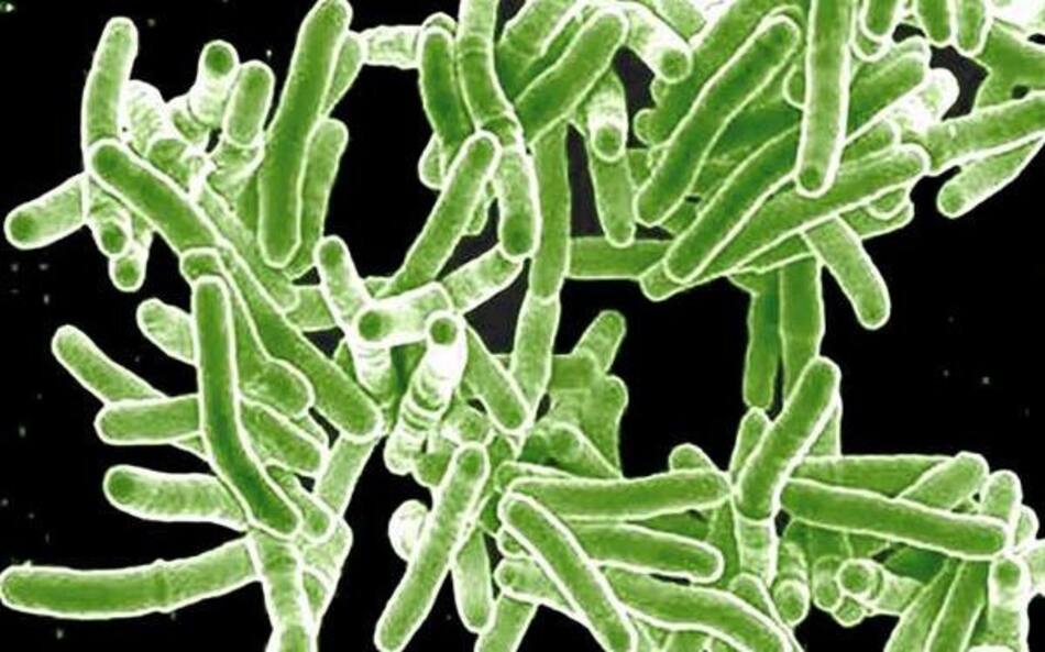 ¿Cuáles son las superbacterias más resistentes? Acinetobacter baumannii