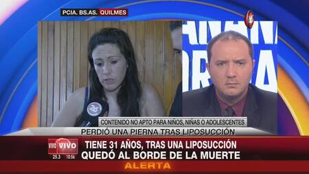 Mariela Ayala - Mujer que sufrió amputación