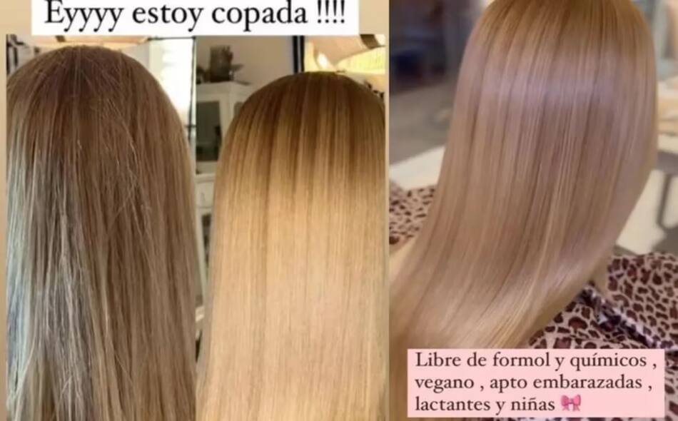 El tratamiento "apto embarazadas" que se realizó Nicole. Foto: Instagram/nikitaneumannoficial