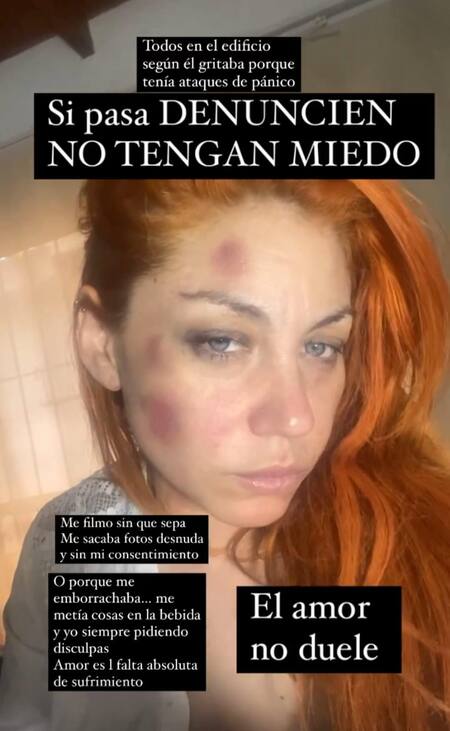 Lourdes de Bandana denunció un ataque de violencia de género. Foto: Instagram.