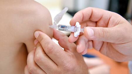 Sociedad, sarampión