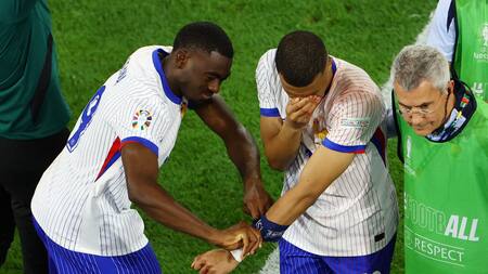 Mbappé se fracturó la nariz en el debut de Francia en la Eurocopa. Foto: Reuters